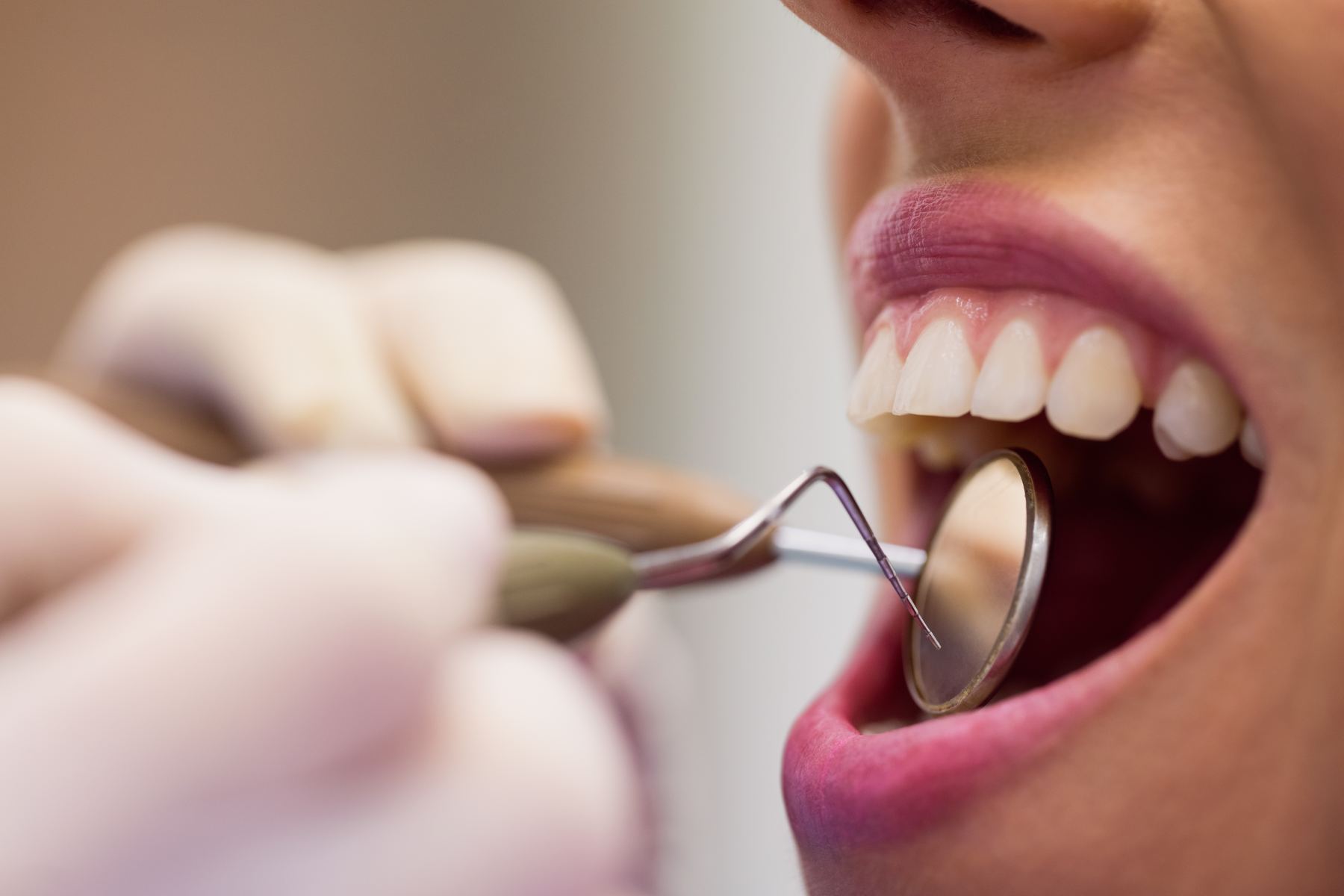 Paciente sonriendo en control dental